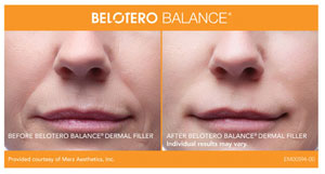 Juvederm® | Restylane® Hicksville NY